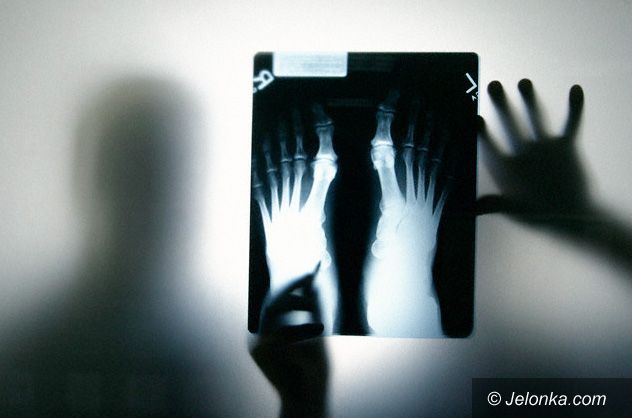 JELENIA GÓRA: Szpital wojewódzki bez rentgena