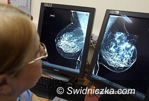 Świdnica: Przyjechał mammobus